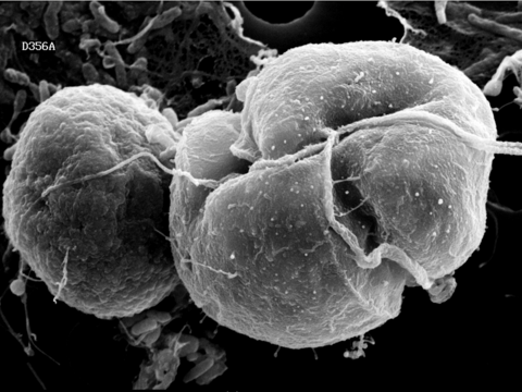 A scanning electron micrograph of Karlodinium veneficum cell attached to a prey cryptophyte in the process of ingestion.